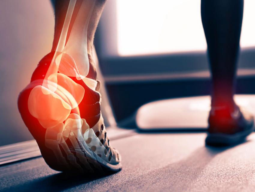 Custom Orthotics Custom Orthotics